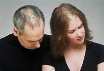 best-hair-loss-shampoo-man and woman