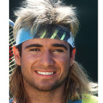 celebrity-hair-loss-agassi-3