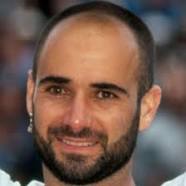celebrity-hair-loss-andre-agassi