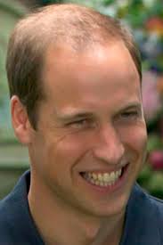celebrity-hair-loss-prince-william-2